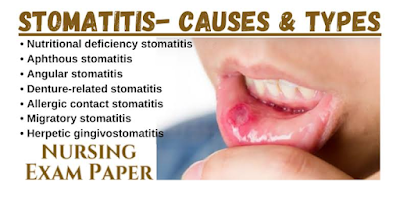 Stomatitis definition Stomatitis treatment Stomatitis in dogs Stomatitis pictures Stomatitis symptoms Stomatitis causes Stomatitis contagious Stomatitis in cats Stomatitis cocktail Stomatitis in toddler Stomatitis definition medical Stomatitis definition in cats Stomatitis definition in hindi Stomatitis definition deutsch Stomatitis definition in english Stomatitis definition in tagalog Stomatitis definition pronunciation Stomatitis definition dog Stomatitis definition anatomy Stomatitis treatment otc Stomatitis treatment adults Stomatitis treatment for toddlers Stomatitis treatment pediatric Stomatitis treatment child Stomatitis treatment in babies Stomatitis treatment cats Stomatitis treatment cvs Stomatitis treatment natural remedy Stomatitis in dogs symptoms Stomatitis in dogs treatment Stomatitis in dogs mouth Stomatitis in dogs and cats Stomatitis in dogs images Stomatitis in dogs pictures Stomatitis in dogs meaning Stomatitis in dogs surgery Stomatitis in dogs dvm 360 Stomatitis pictures in cats Herpetic stomatitis pictures Aphthous stomatitis pictures Nicotine stomatitis pictures Herpes stomatitis pictures Angular stomatitis pictures Vesicular stomatitis pictures Stomatitis tongue pictures Feline stomatitis pictures Stomatitis symptoms in cats Stomatitis symptoms toddler Stomatitis symptoms mayo clinic Stomatitis symptoms in hindi Stomatitis symptoms home remedies Stomatitis symptoms in dogs Stomatitis symptoms tongue Stomatitis symptoms merck manual Stomatitis symptoms relief Stomatitis causes in cats Stomatitis causes and symptoms Stomatitis causes in dogs Angular stomatitis causes Aphthous stomatitis causes Herpetic stomatitis causes Denture stomatitis causes Recurrent stomatitis causes Uremic stomatitis causes Stomatitis contagious cats Stomatitis contagious period Stomatitis contagious adults Is stomatitis contagious between cats Herpetic stomatitis contagious Aphthous stomatitis contagious Stomatitis toddler contagious Angular stomatitis contagious Candidal stomatitis contagious Stomatitis in cats treatment Stomatitis in cats photos Stomatitis in cats vca Stomatitis in cats pictures Stomatitis in cats symptoms Stomatitis in cats deadly Stomatitis in cats contagious Stomatitis in cats treatment at home Stomatitis in cats causes Stomatitis cocktail suspension Stomatitis cocktail ingredients Stomatitis cocktail tmf Stomatitis cocktail dosing Stomatitis cocktail bereiding Stomatitis cocktail gebruik Stomatitis cocktail maalox Stomatitiscocktail kind Stomatitis cocktail &#3588;&#3639;&#3629; Stomatitis in toddlers treatment Stomatitis in toddlers pictures Stomatitis in toddlers contagious Herpetic stomatitis in toddlers Herpetic stomatitis in toddlers treatment Gingivitis stomatitis in toddlers Stomatitis virus in toddlers Aphthous stomatitis in toddlers Herpes stomatitis in toddlers Inflammation Redness Rubor