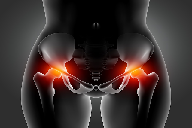 COMPREHENSIVE GUIDE TO HIP REPLACEMENT SURGERY IN AHMEDABAD