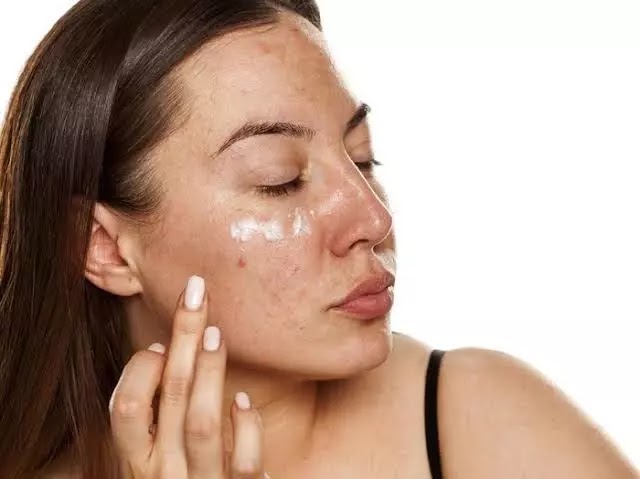 Efek Samping Cream Marwah Skincare
