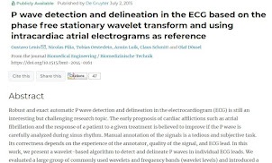 心房細動検出に必須な、P波について最新のNATUREが取り上げ