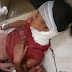 तेंदुए के हमले में थारू बालिका घायल, सीएचसी में चल रहा इलाज