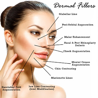 cosmetic injectables Melbourne