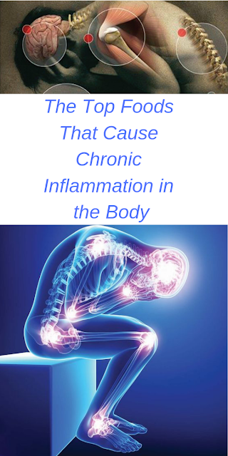 The Top Foods That Cause Chronic Inflammation in the Body