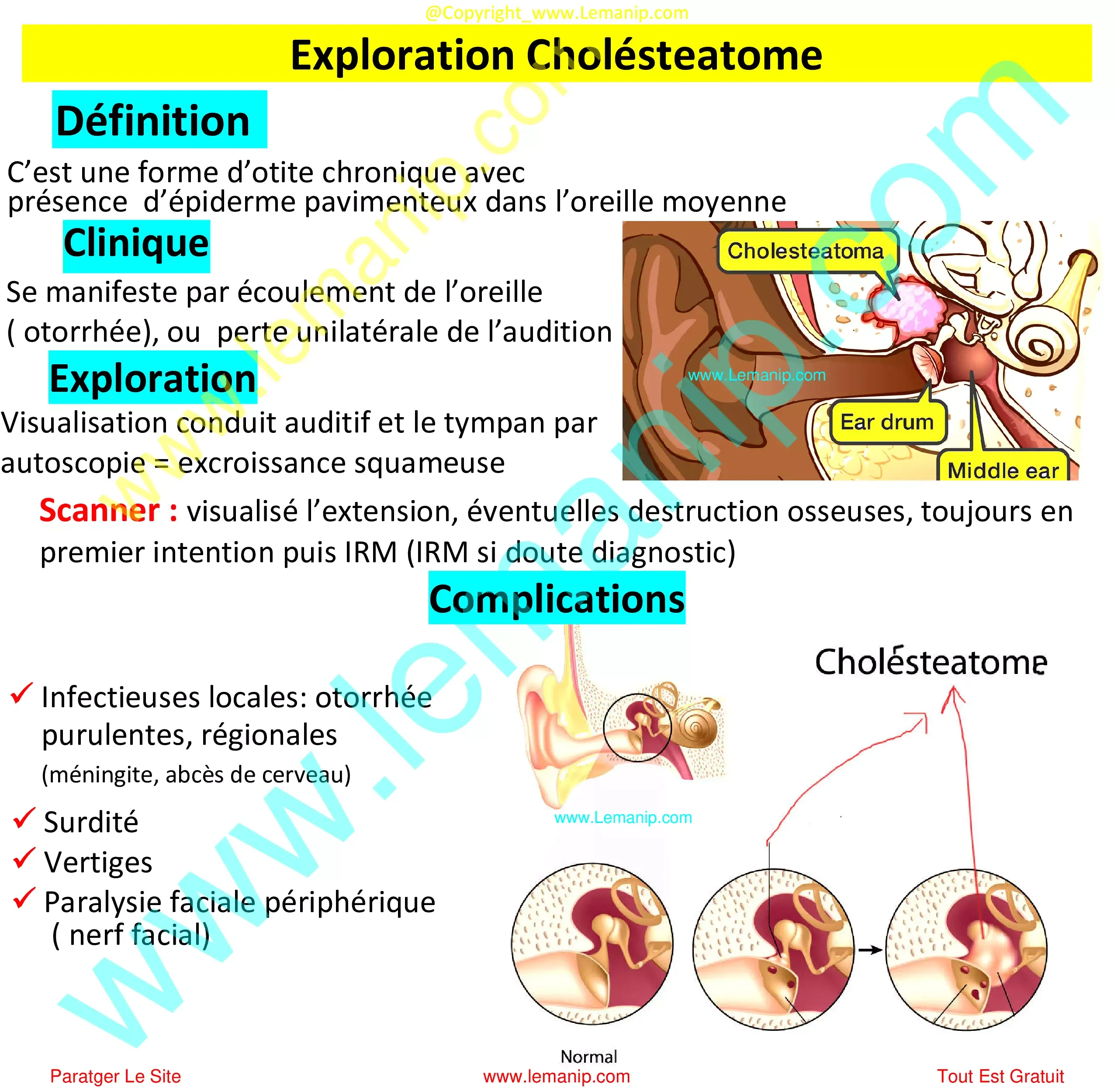 Exploration Cholésteatome