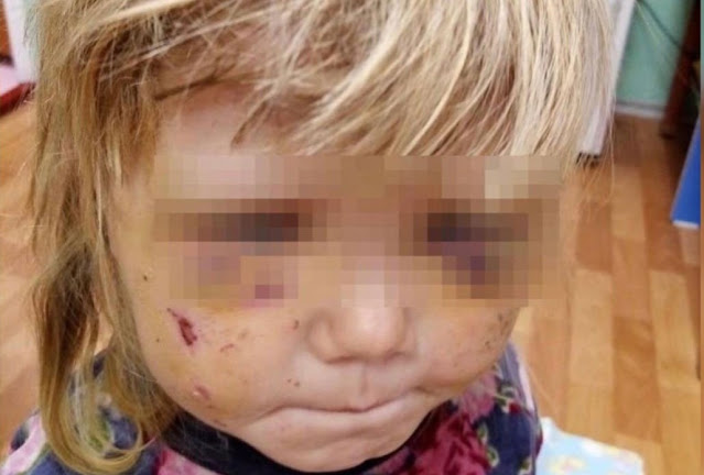 Малышек трех и семи лет жестоко избивал родной брат-уголовник на глазах у родителей