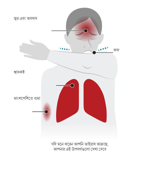 What Are the Symptoms of Corona Disease?