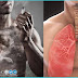 Chronic Respiratory Diseases : Understanding COPD and its Impact