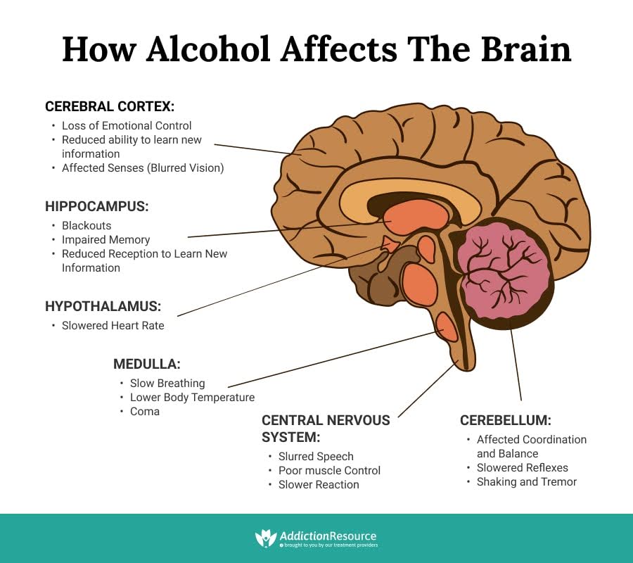 Alcohol and Brain #Infographic