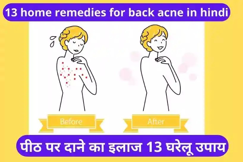 back acne home remedies in hindi