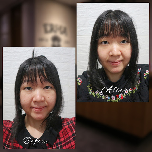 Before-after IPL treatment di ERHA CLINIC