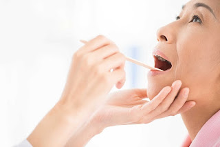 Điều trị răng bị vỡ có nên nhổ không? Tư vấn nha khoa-2