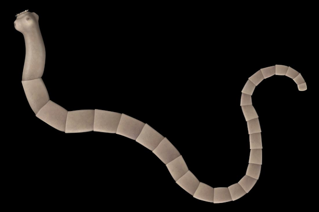 Tapeworms: DISEASES CAUSED BY BACTERIA, VIRUS, WORMS AND PARASITES