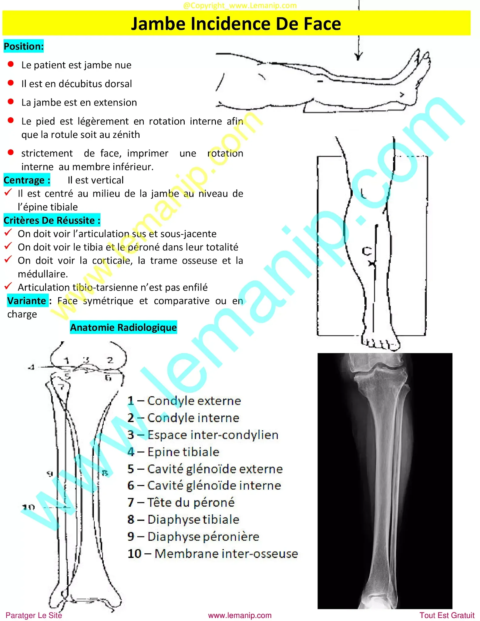 ankle xray,foot xray,broken foot x ray,fractured foot x ray,x ray of plantar fasciitis,twisted ankle xray,fracture x ray foot,ankle injury x ray,plantar x ray,broken foot xrays