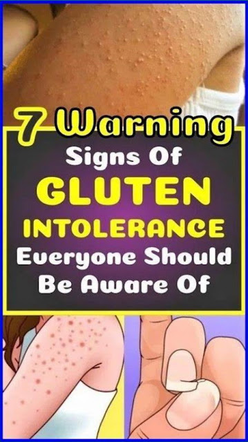 7 Symptoms Indicating That You Are Gluten Intolerant