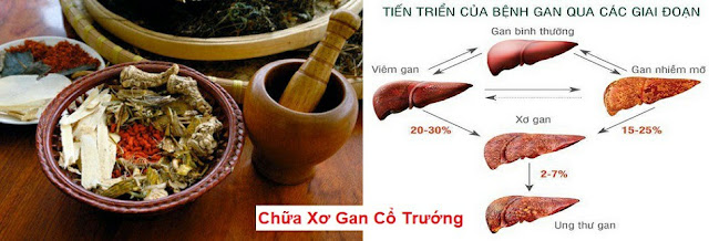 TOA THUỐC ĐÔNG Y CỔ TRUYỀN VIỆT NAM - CHỮA XƠ GAN CỔ TRƯỚNG