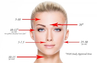 botox_ichhori.com