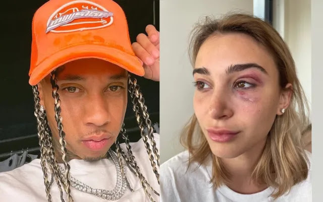 US Rapper Tyga arrested on domestic violence charges after ex-girlfriend posts picture of bruised eye