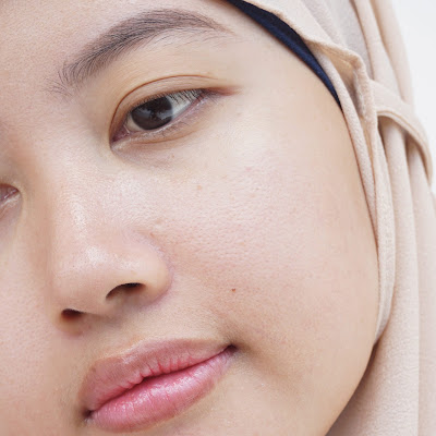 hasil pemakaian my skin hero facetamin glass skin serum