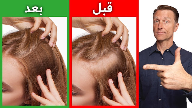 كيفية زيادة كثافة الشعر بشكل طبيعي..ووصفات لعلاج الشعر الخفيف