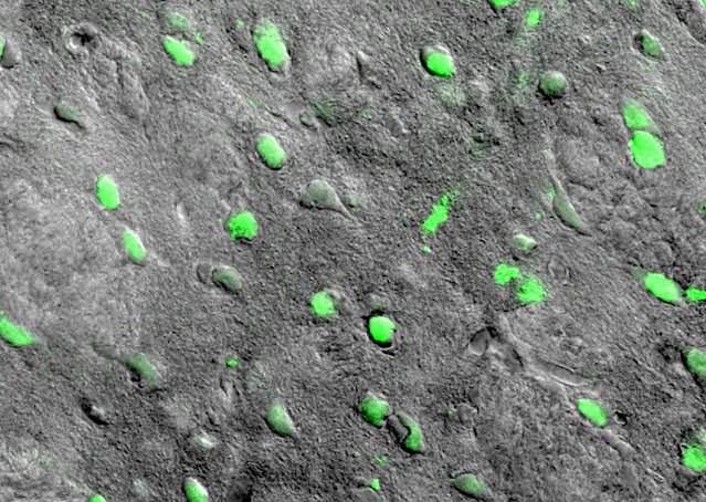 На изображении в проходящем свете показаны клетки (выделены зеленым цветом), которые дистанционно включаются с помощью магнитных полей.