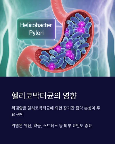 헬리코박터균 감염 여부
