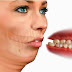 Chỉnh răng hô móm bằng phẫu thuật có tốt hơn niềng răng?