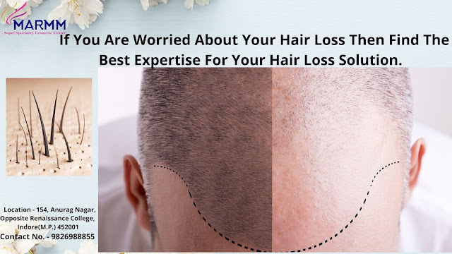 'hair transplant cost in indore' hair transplant price in indore'