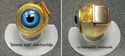 bionic eye microchip