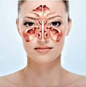 Sinusi predstavljaju šupljine koje se dele na one koji se nalaze u kostima unutar čeonog dela, zatim u vrhu nosa među očnim dupljama, sinuse u delu gornje vilice, kao i one koji su u unutrašnjosti očnih duplji