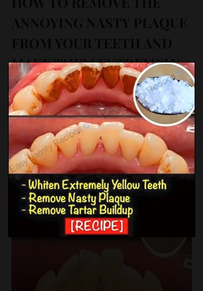 HOW TO REMOVE THE ANNOYING NASTY PLAQUE FROM YOUR TEETH AND MAKE THEM EXTREMELY WHITE