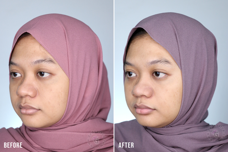 Hasil Pemakaian AVOSKIN Your Skin Bae Vitamin C