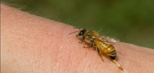 Home Remedies For Wasp Stings