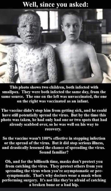 Two boys, one who had been vaccinated against Smallpox and 1 who hadn't
