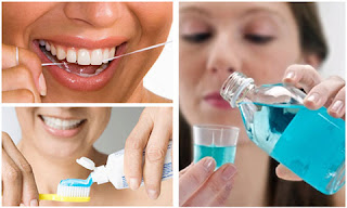 Chăm sóc răng sau khi cắm implant như thế nào-3
