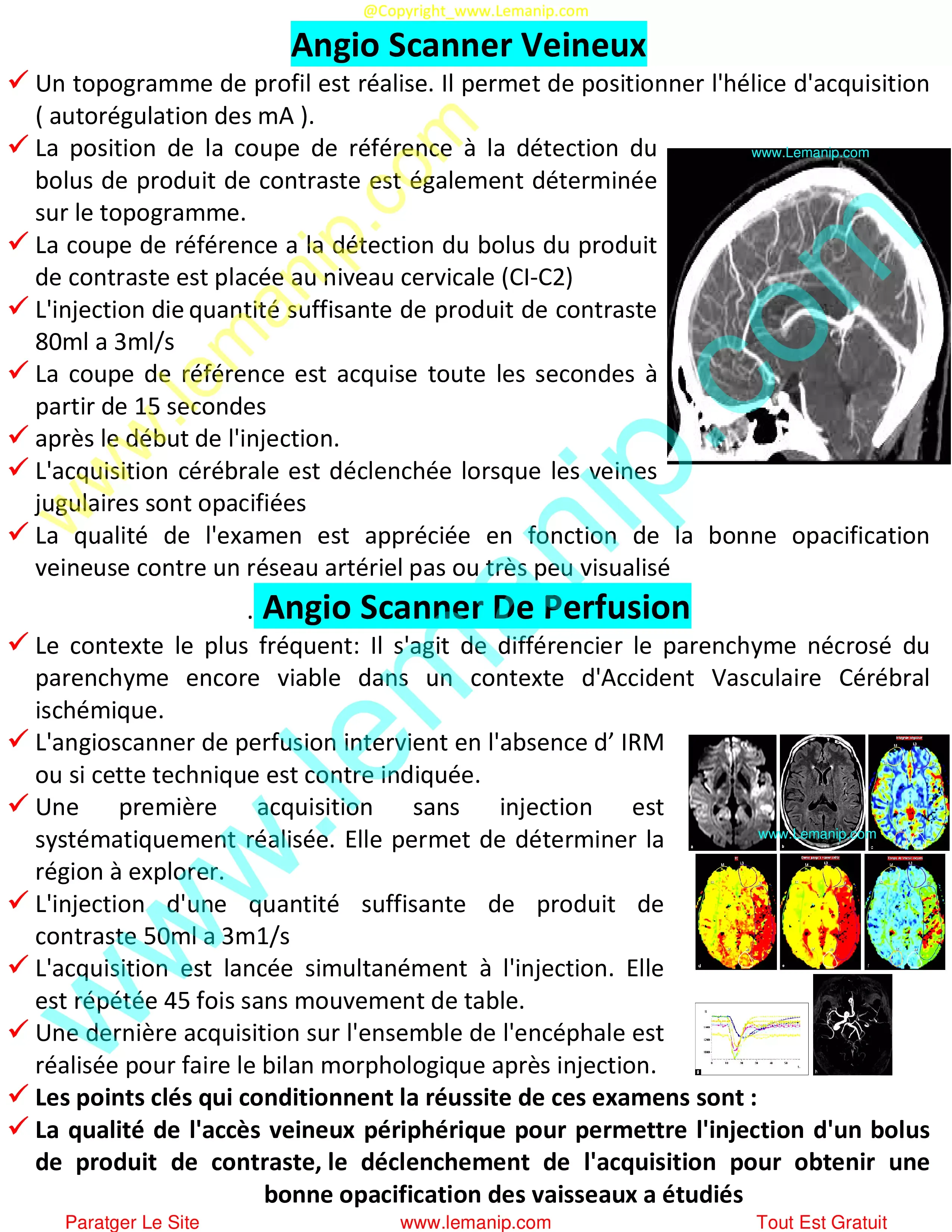 Angio Scanner Veineux