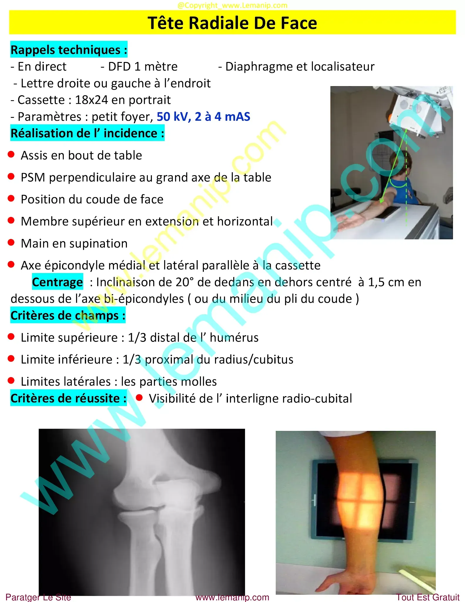 avant bras,elbow pain orthopedic doctor,dr henry hand and wrist,elbow pain treatment near me,premier orthopedics hand specialist,bras avant,hand man,orthopedic hand,orthopedic wrist,orthopedic elbow,orthopedic carpal tunnel