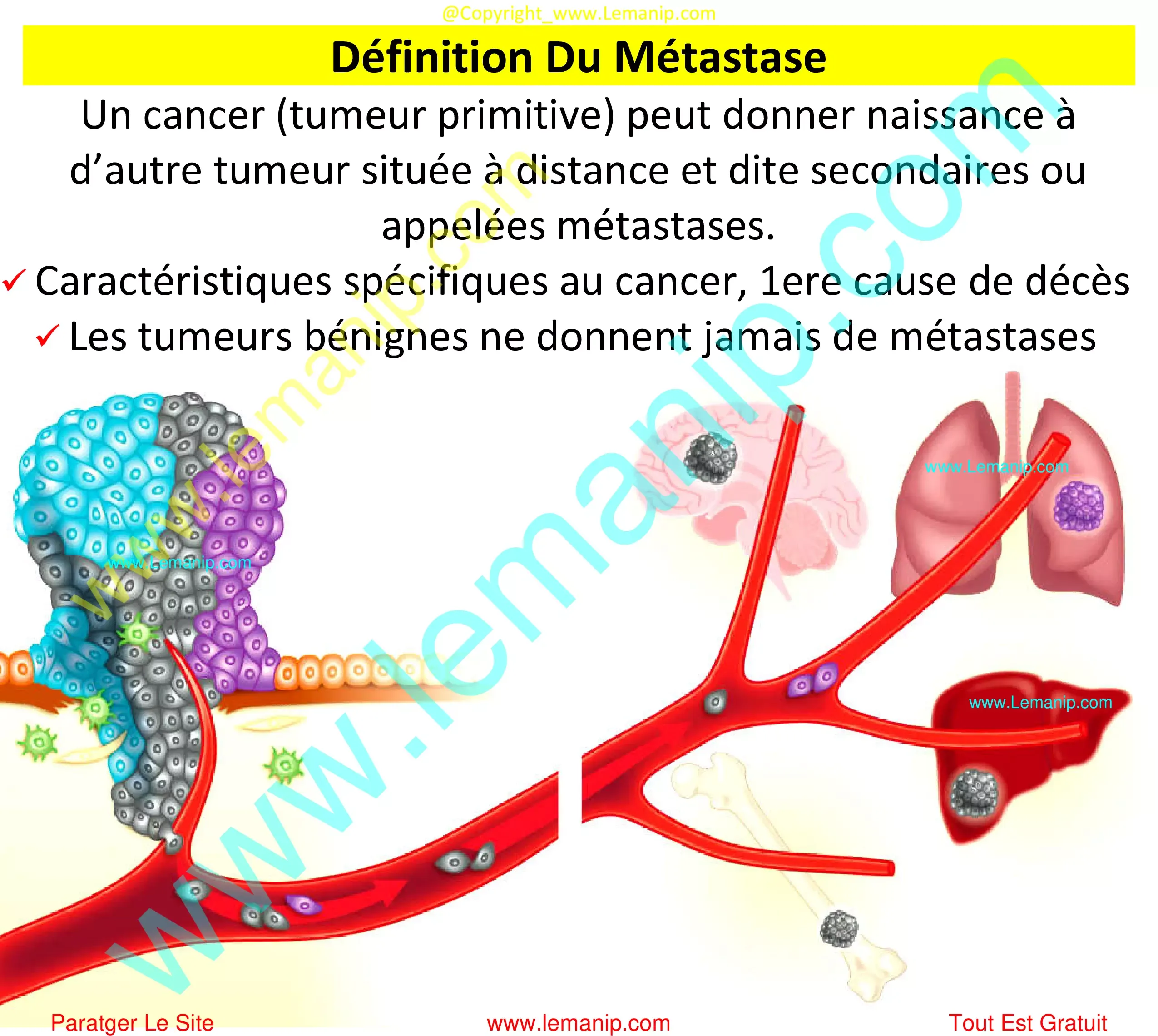 Définition Du Métastase