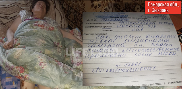 В Самарской области женщина-диабетик с гангреной не может добиться группы инвалидности