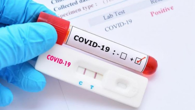 Associação das Farmácias acusa Minsa de complicar com os testes de covid-19