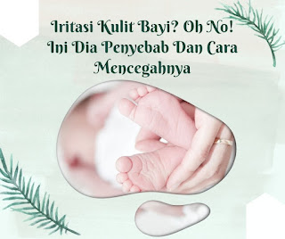 penyebab iritasi kulit bayi