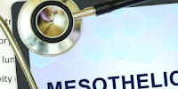 Mesothelioma Litigation Can Help You
