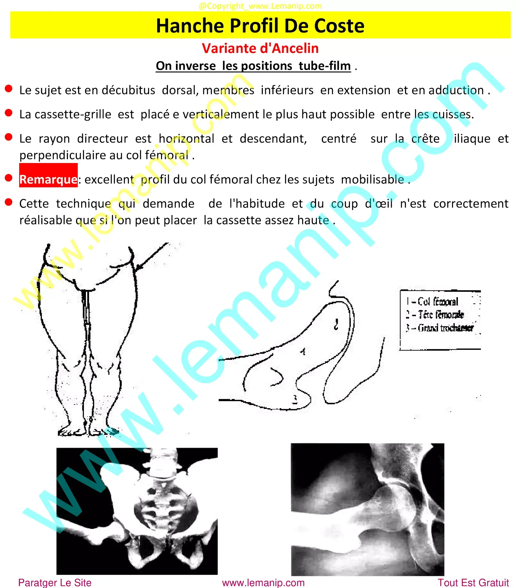 sacrococcygeal joint,pvns,pelvic floor mri,popping hip joint,posterior hip replacement,hip ligaments,rheumatoid,chirurgie hanche clinique privée,douleur hanche et cuisse,chirurgie hanche