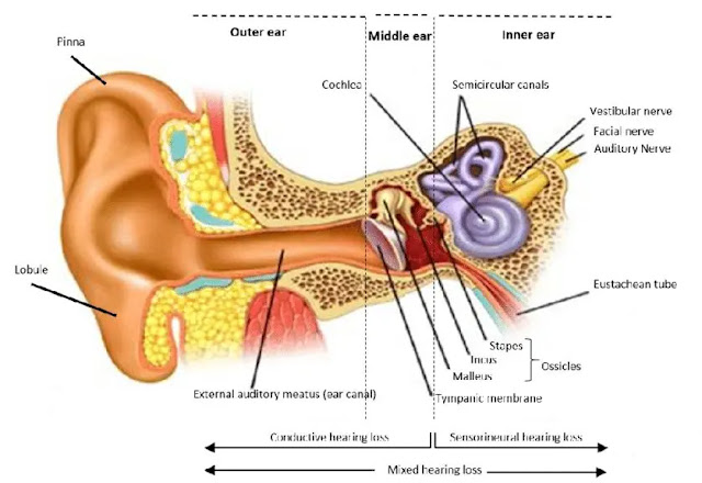 Acoustic Neuroma: Symptoms, Causes, Treatments, and More