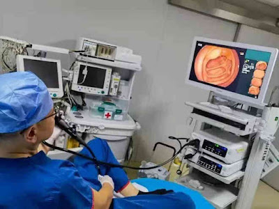 doctor performs colonoscopy on himself