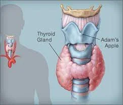 Hashimoto's thyroid disease How does it happen?  Hashimoto's disease, a name that hides one of the world's most common autoimmune diseases, in which the immune system attacks itself. What is this disease? What are the causes and symptoms of inactivity in the thyroid gland, which causes various health problems?  The thyroid gland is a vital organ whose hormones control many processes in the human body. It is estimated that one in 10 people in Germany suffers from chronic inflammation of the thyroid gland, as the immune system attacks his body. For patients, the diagnosis is lifelong, because the disease cannot be cured, according to a report in Deutsche Welle.  Hashimoto's causes Danny Willender, an endocrinologist in Leipzig, told the German MDR channel that the causes of the disease are several, including hormonal changes, for example during pregnancy or obvious stress. Viral infections can also cause the disease to appear or progress in stages. And he indicated that in Hashimoto's patients, the increase in iodine can also have a negative effect on immunity, but pointed out that the amount of iodine in the daily food is harmless.  The doctor added that the reasons for the transformation of the immune system and its destruction in this way are not yet known, and it is believed that there are genetic factors, and environmental factors are also being discussed. Unfortunately, the disease cannot be prevented. Reducing stress and at least a healthy lifestyle can help positively influence the course of the disease, says the doctor.  Endocrinologist Felender added that since the disease often leads to hypothyroidism, this is treated by giving thyroid hormones in the form of tablets. "We are dealing with autoimmune outcomes, so unfortunately there is no cure," he adds.  Hypothyroidism In general, if the thyroid gland is underactive, which is called "hypothyroidism", it produces too few hormones. The thyroid gland is a vital organ, and its hormones control many processes in the human body. When these hormones are missing, various diseases can appear, as the German health website "Heal Praxis" mentioned.  Possible symptoms of an underactive thyroid According to the reports of the German Society of Endocrinology, the physical signs of hypothyroidism are:  Increased sensitivity to cold -overweight -slow pulse rate -fatigue -cool dry skin -hair loss -water retention -muscle weakness -Constant need to sleep -Difficulty concentrating -Depression -constipation.  While the German Institute for Quality and Efficiency in Health Care revealed other possible symptoms of hypothyroidism, which are:  Shortness of breath -idle -Goiter -deep hoarse voice -swollen tongue -Heavy periods or irregular menstruation -infertility -Erectile Dysfunction -Tingling or numbness -slow reactions.  Causes of an underactive thyroid Causes of hypothyroidism include: autoimmune thyroiditis (Hashimoto's thyroiditis mentioned above), congenital dysfunction (1 child per 3500 births), subacute thyroiditis, and pituitary dysfunction.  Furthermore, an apparent iodine deficiency or certain medications such as antidepressants can lead to an underactive thyroid. If dysfunction is not treated, a variety of, sometimes serious, problems can develop. But sometimes the thyroid gland recovers on its own, for example when the inflammation subsides.  Diagnosis and treatment To make a diagnosis, the doctor will first ask about your symptoms and will touch your thyroid gland. Since many of the symptoms of hypothyroidism can have other causes, blood tests are done to reach a clear diagnosis, as quoted by the German "Heal Praxis" website.  In order to be able to recognize and treat congenital hypothyroidism early, the value of TSH is routinely determined in all newborns. If the result is abnormal, thyroid hormone levels are also measured. The examination is not recommended for adults.  In the treatment of hypofunction, the missing thyroid hormone is replaced with a drug that matches the body's own hormone. The active ingredient brings hormone levels back to the normal range. As a result, symptoms usually disappear completely. The treatment takes about 2 to 3 months.  Depending on the cause of hypothyroidism, treatment may be temporary or lifelong. In the case of decreased latent function, only the TSH value is increased.  Protection The German Institute for Quality and Efficiency in Healthcare has stated that hypothyroidism due to iodine deficiency can be prevented by providing an adequate amount of iodine. However, in Germany, for example, iodine deficiency is rarely the cause, due to its sufficient availability in table salt and other foodstuffs.  Experts advise ensuring adequate iodine intake in the diet, such as in milk or dairy products and in sea fish. It is also recommended to use iodized table salt.  Some supplements also contain iodine. However, the daily total iodine will be a problem for the body if it exceeds more than 100 micrograms of iodine, as anyone who consumes too much iodine in the long term increases their risk of developing hyperthyroidism. However, excessive doses of iodine-containing food are rare, except for eating dried algae, especially seaweed, which contains very large amounts of iodine.