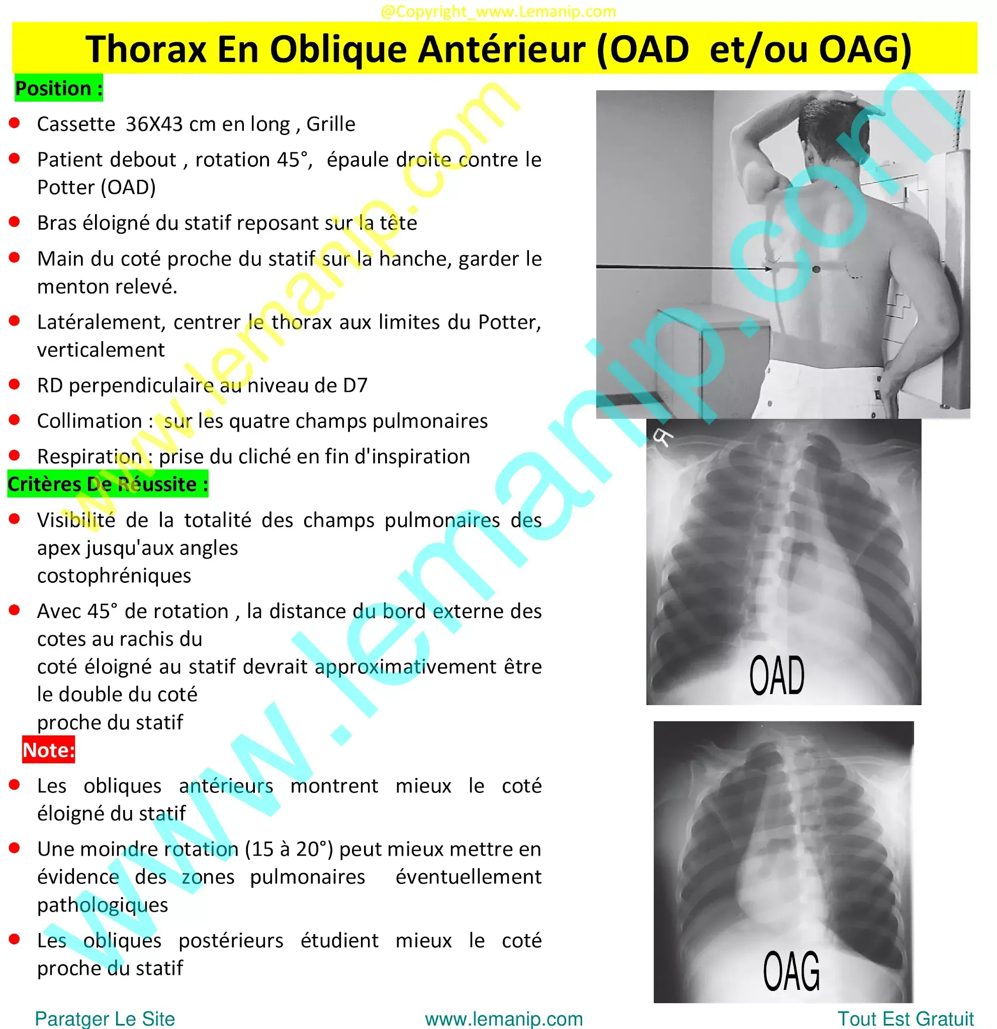 mesothelioma chest x ray,asbestos lung x ray,asthma chest x ray,asthma lungs x ray,urgent care with chest x ray near me,chest xray pa and lateral,ppd chest x ray,chest xray tb,chest x ray pa and lateral,chest xray pa lateral
