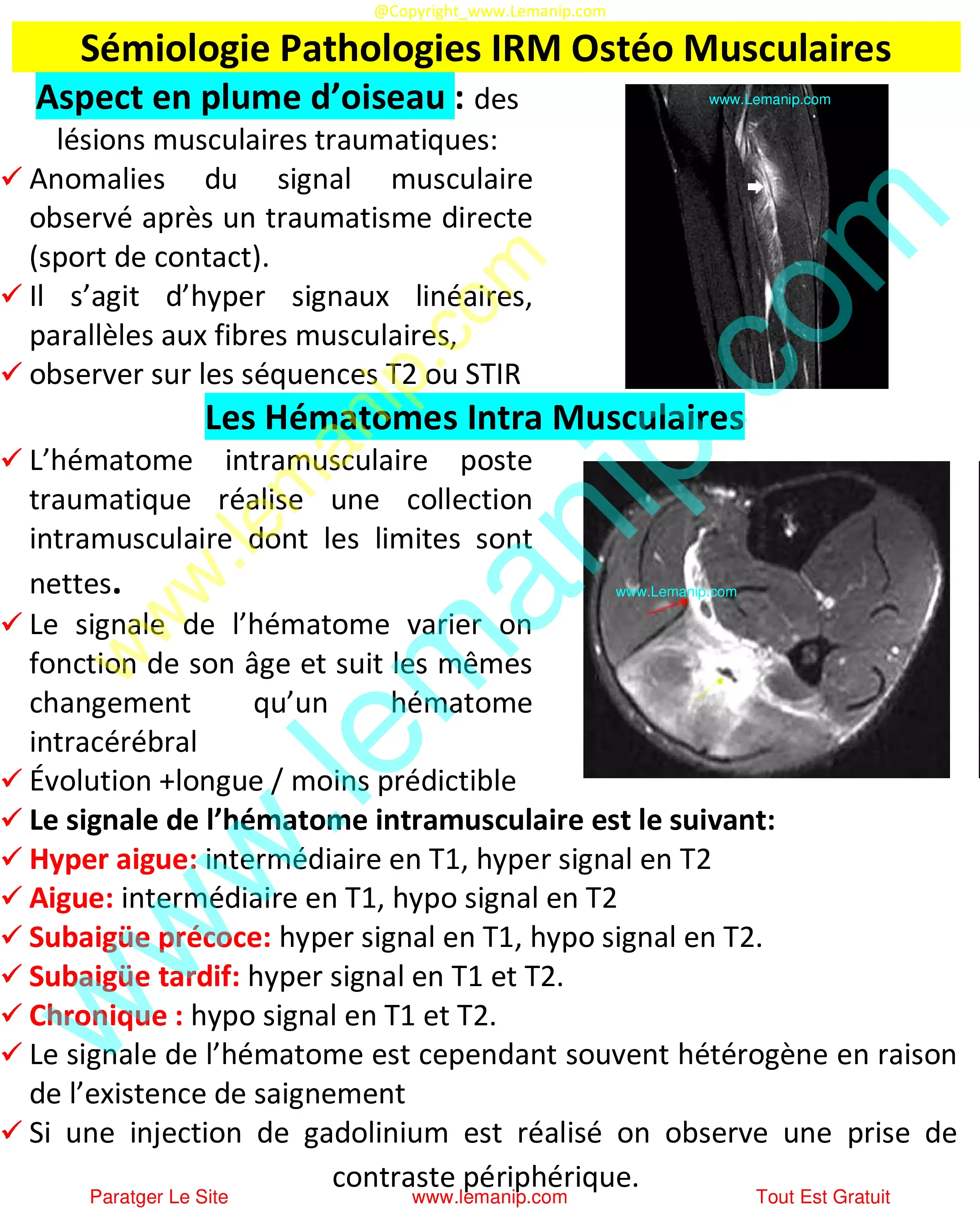 Sémiologie Pathologies IRM Ostéo Musculaires