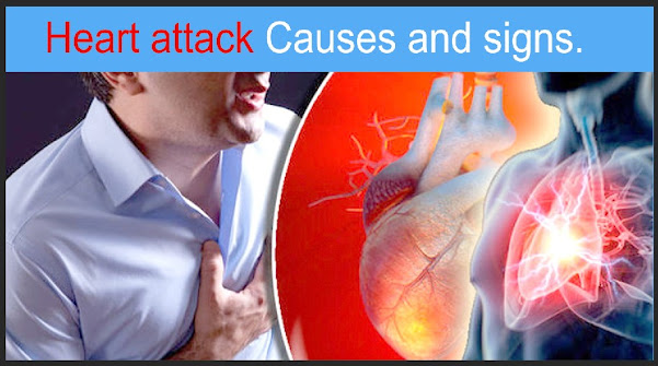 Heart attack Causes and signs