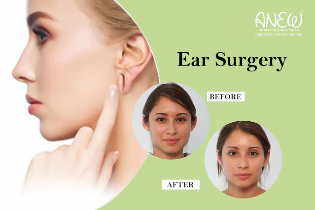 Ear Surgery in Bangalore.