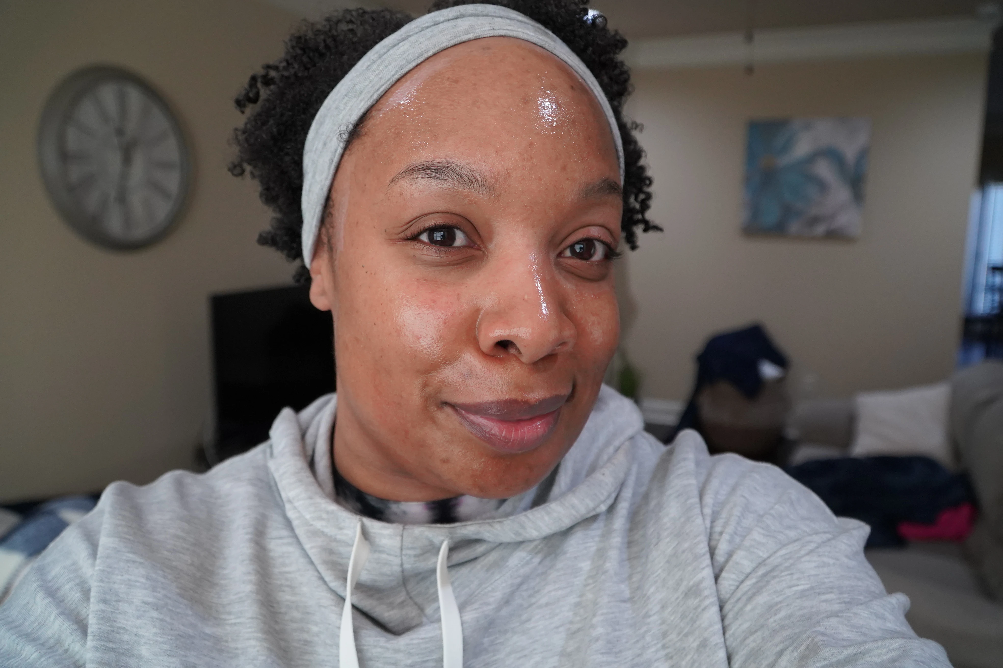 Are Chemical Peels Worth it for Black Skin?  My First Experience on Day 1